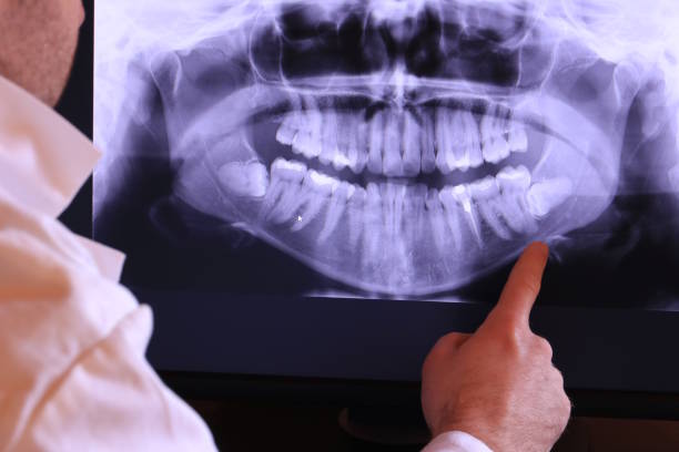Best Tooth Infection Emergency Dentist  in Vienna Bend, LA