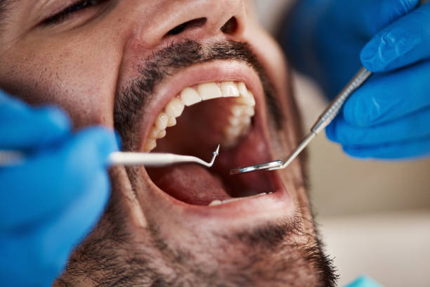 Best Tooth Pain Emergency Relief  in Vienna Bend, LA